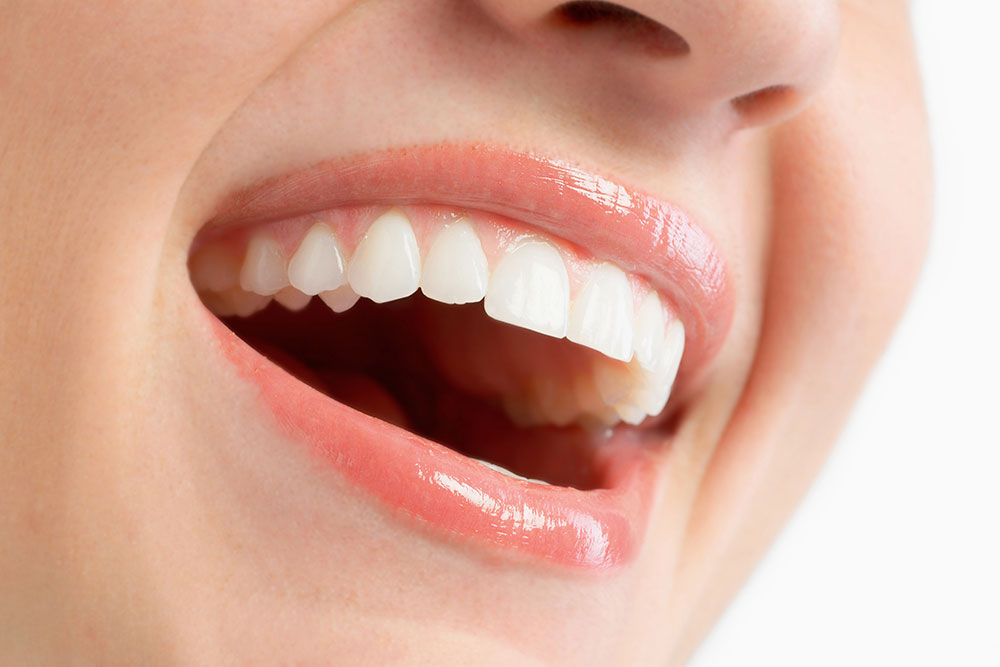 Mulher sorrindo e mostrando clareamento dental