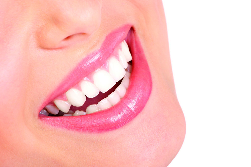 Mulher sorrindo e mostrando lente de contato dental